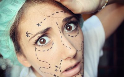 ¿Cuál me conviene más? ¿Neuromodulador o Ácido hialurónico?