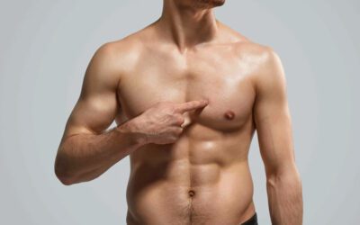 Ginecomastia: Causas, Prevención y Tratamiento