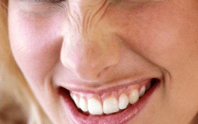 6 Aspectos de la nariz que podemos corregir en una rinoplastia