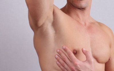 Hipertrofia de los pezones en hombres: causas y soluciones quirúrgicas