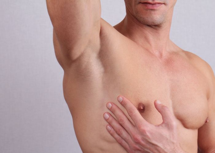 Hipertrofia de los pezones en hombres: causas y soluciones quirúrgicas