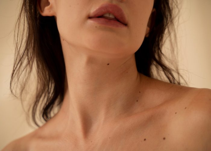 Extirpación de lesiones cutáneas: ¿dermatólogo o cirujano plástico?