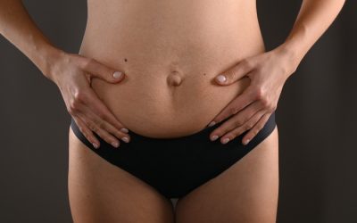Síntomas de la diástasis abdominal y cuándo recurrir a cirugía en Madrid